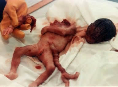 aborto Mensagem: Aborto